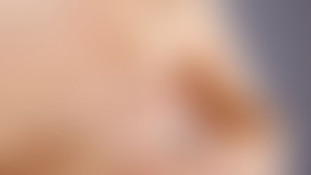 Ինչով է այլընտրանքային բուժումը սպառնում վատթարացնել կրծքագեղձի քաղցկեղի կանխատեսումը. գիտնականների արձագանքը