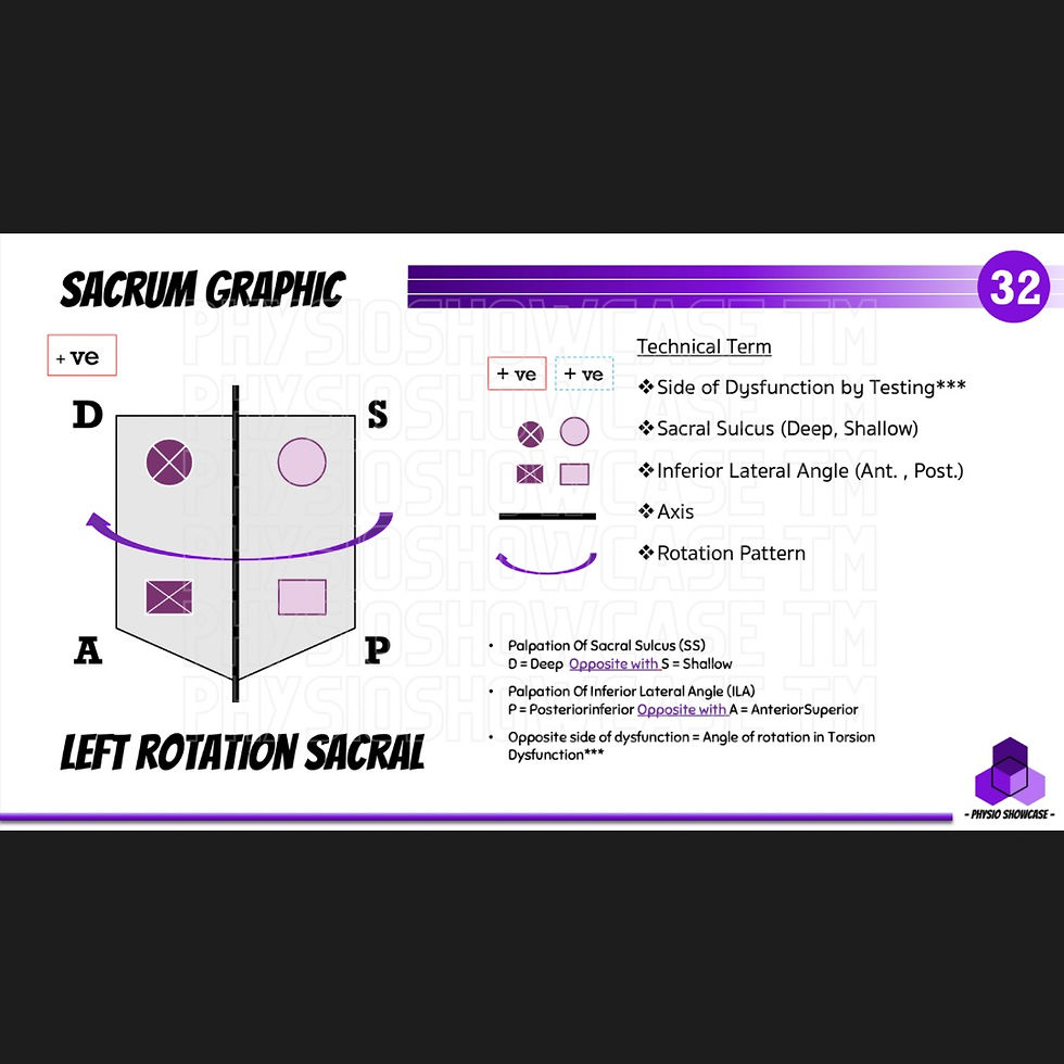 Thumbnail: Sacroiliac Joint Dysfunction (2023)
