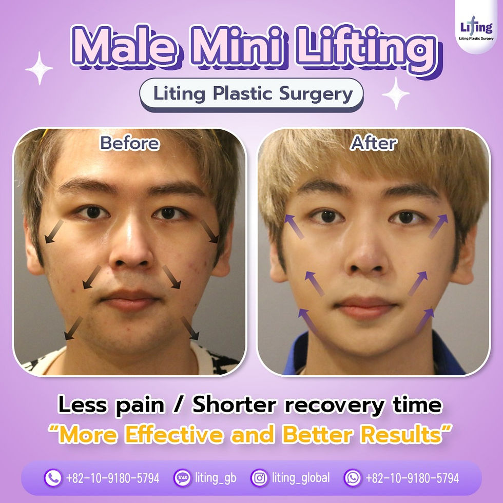 หน้าเรียว V-shape