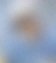 ศัลยกรรมลดโหนกแก้มที่ โรงพยาบาลบาโนบากิ (BANOBAGI)