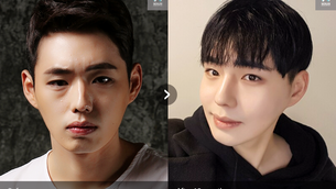 รีวิว ศัลยกรรมผู้ชาย หล่อละมุนเหมือนไอดอล - โรงพยาบาลวอนจิน