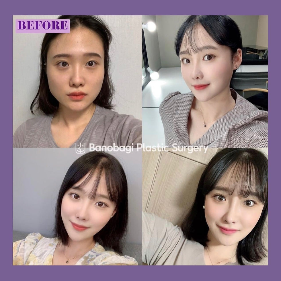 ทำตาสองชั้นที่บาโนบากิ