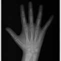 Palmar