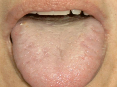 Umidità interna nel corpo