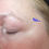 Thumbnail: Oog Pads - Instant Effect