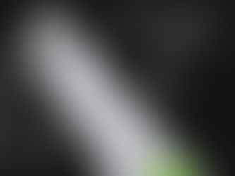 Интраорален скенер VRN Medical за дигитален отпечатък в стоматологията