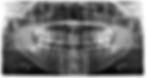 Wisdom teeth removal Bright Oak Dental