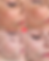 Pico Sure Pro Laser Facials and Skin Rejuvenation