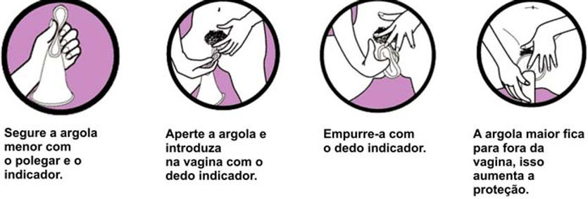 Como-colocar-camisinha-feminina.jpg