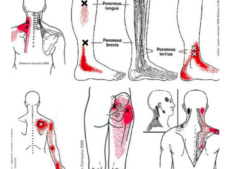 How Dry Needling is Shaping Smarter Clinical Decisions: Referral Patterns