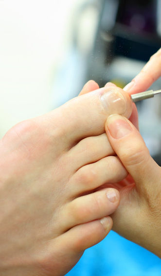 Nail on foot getting treated