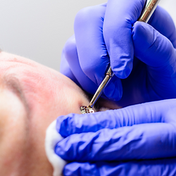 Gesichtsreinigung – Behandlung von Grieskörnern für ein ebenmässiges Hautbild