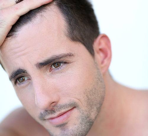 Portrait of attractive man with hair concern_edited_edited.jpg