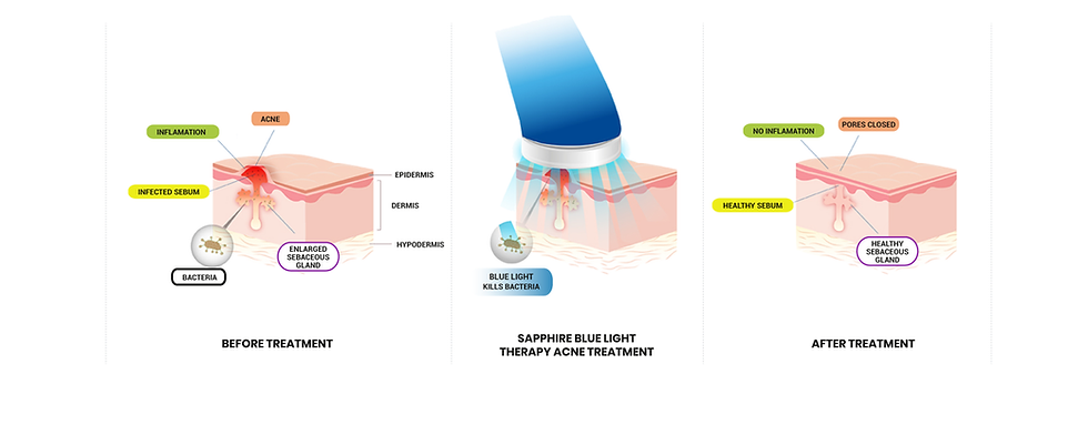 Sapphire LED light therapy device