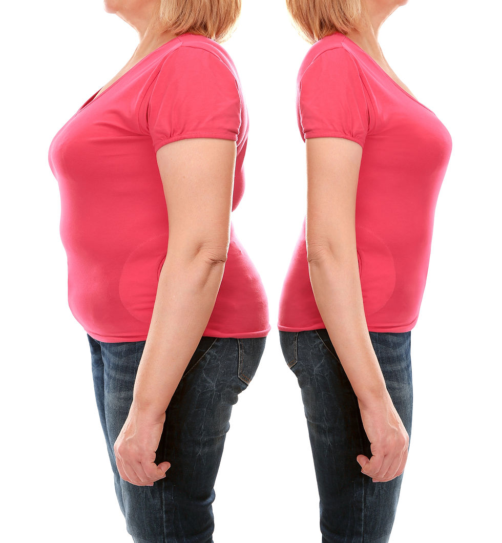 Fat Loss Treatments