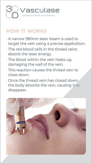 How Vasculase Works