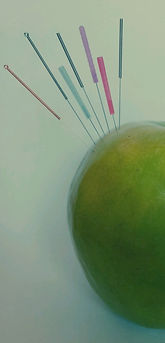 דיקור סיני במודיעין | רונית עומר רפואה סינית