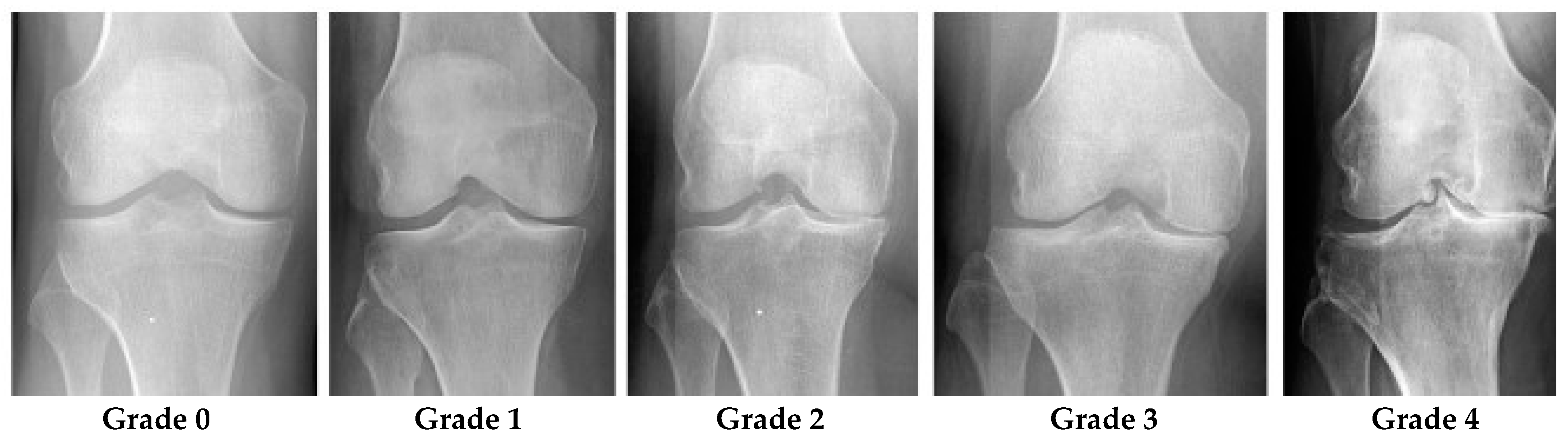 x-ray of knee