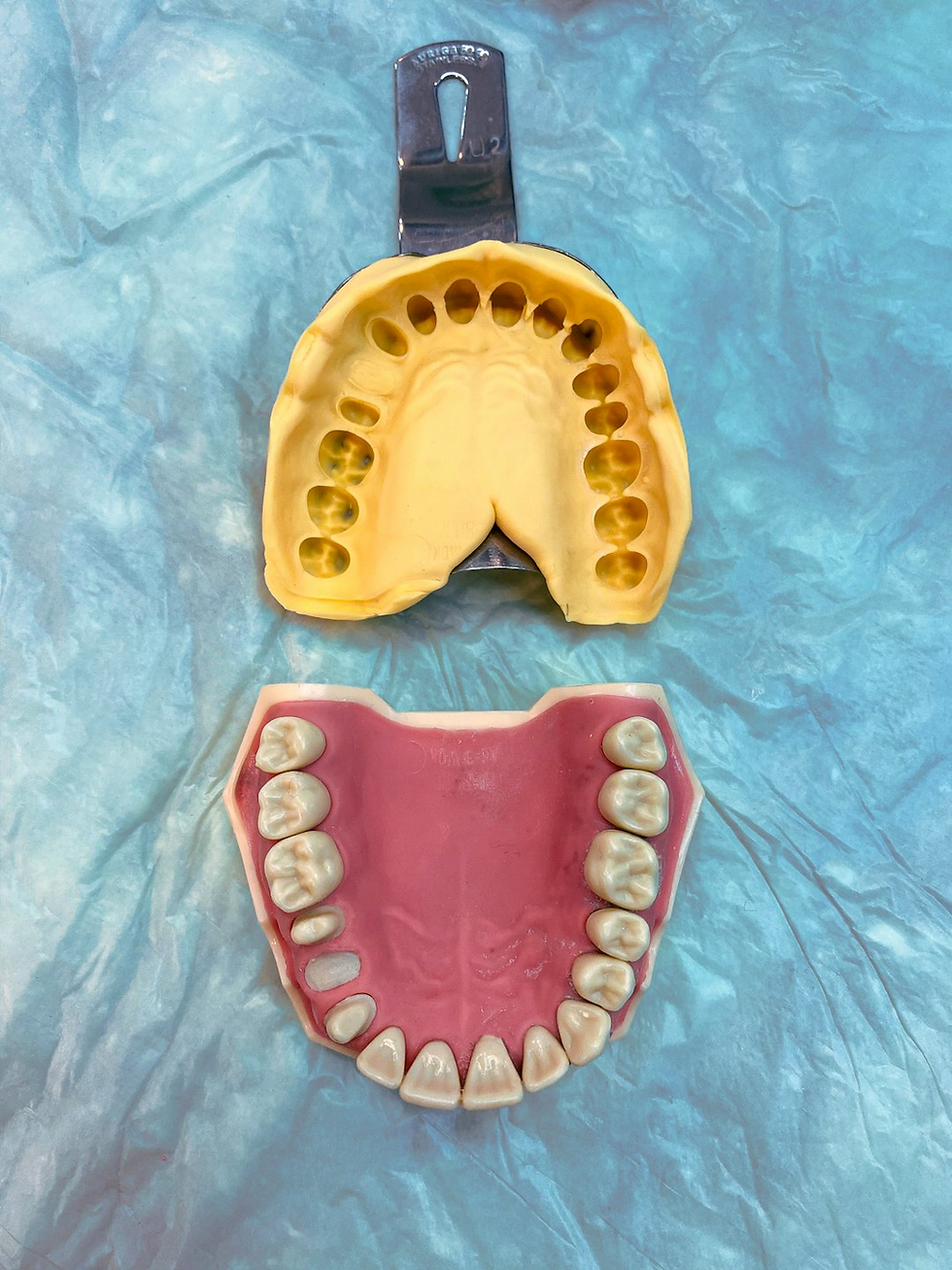 Two dental molds on a textured blue surface. The top is yellow with a metal handle; the bottom is pink with white teeth.