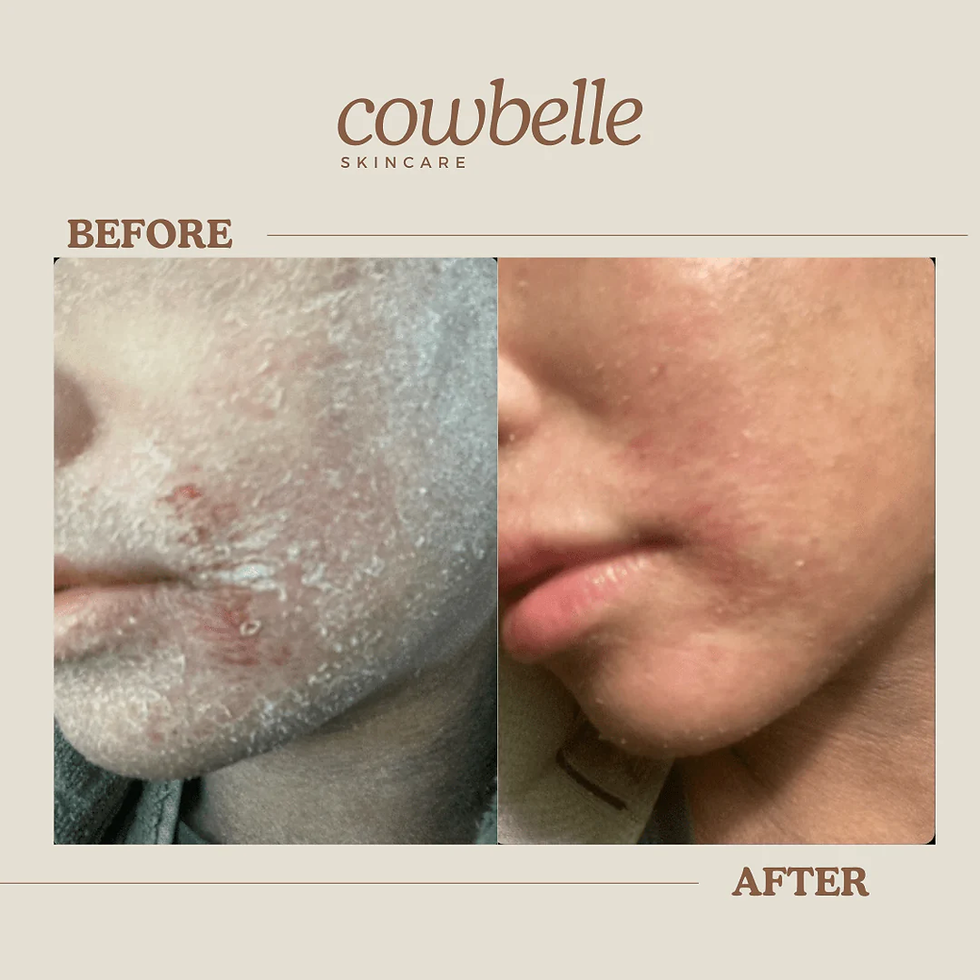 Before-and-after images of facial skin improvement. Left: red, flaky skin. Right: smoother skin. Beige background, "cowbelle skincare" text.