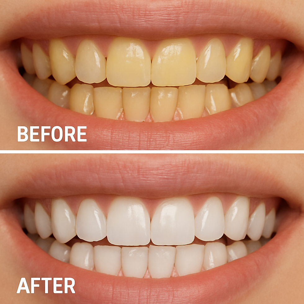 Before and after comparison of teeth whitening. Top shows yellow teeth; bottom shows white teeth. Text: "BEFORE" and "AFTER."