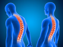 Two blue 3D human figures show highlighted spines; one slouches, the other stands straight. The background is a gradient blue.