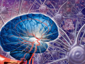 Мозъчна катастрофа: какво води до инсулт?