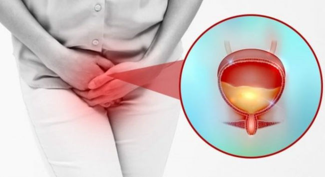 Millones de personas sufren innecesariamente de la Incontinencia Urinaria! He aquí 6 formas naturale