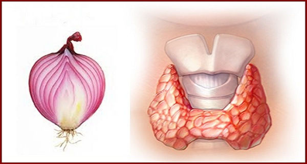Se durmió toda la noche con una compresa de cebolla alrededor de su cuello. Cuando se levantó, fue t