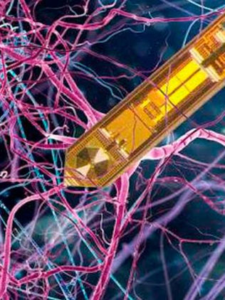 Científicos desarrollan el primer detector de resonancia magnética implantable