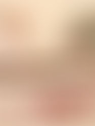 El 82% de muertes por COVID-19 se han dado en pacientes con enfermedades crónicas