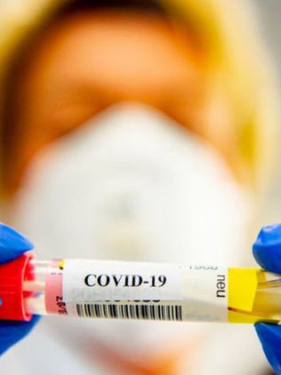 Científicos descubren anticuerpos que bloquean infección del COVID-19 en células