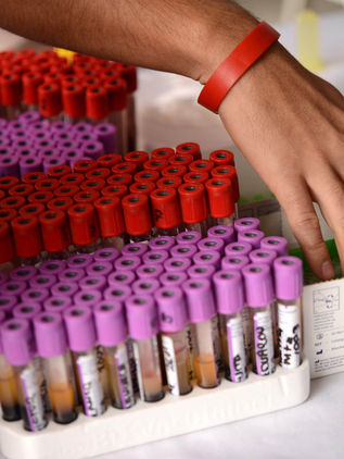 Casos de SIDA en jóvenes se triplica en los últimos años