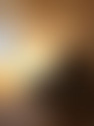 Alertan por diagnóstico tardío del trastorno bipolar en México