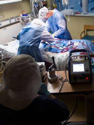 Respiración extracorpórea, la peculiar tecnología que ayuda a salvar vidas ante el COVID-19