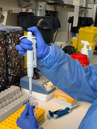 Recibirá México 288 ventiladores y 300 mil pruebas PCR: Ebrard