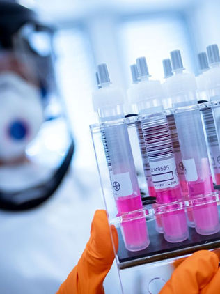 Desarrollan método para predecir propagación de pandemia