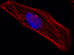 Celo.Cardiomyocytes head to the International Space Station on March 14th