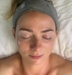 Skin-after.jpg