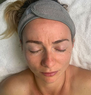 skin-before.jpg
