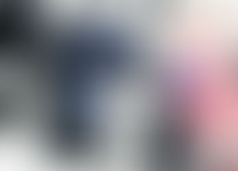 ¿Sabes por que se forman las cataratas en los ojos?