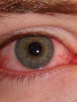 Red eye.jpg