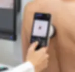 Dermatoscopia Digital y Vigilancia Cutánea