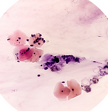 MIcroscopia Vaginal