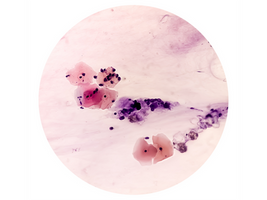 Microscopia vaginal