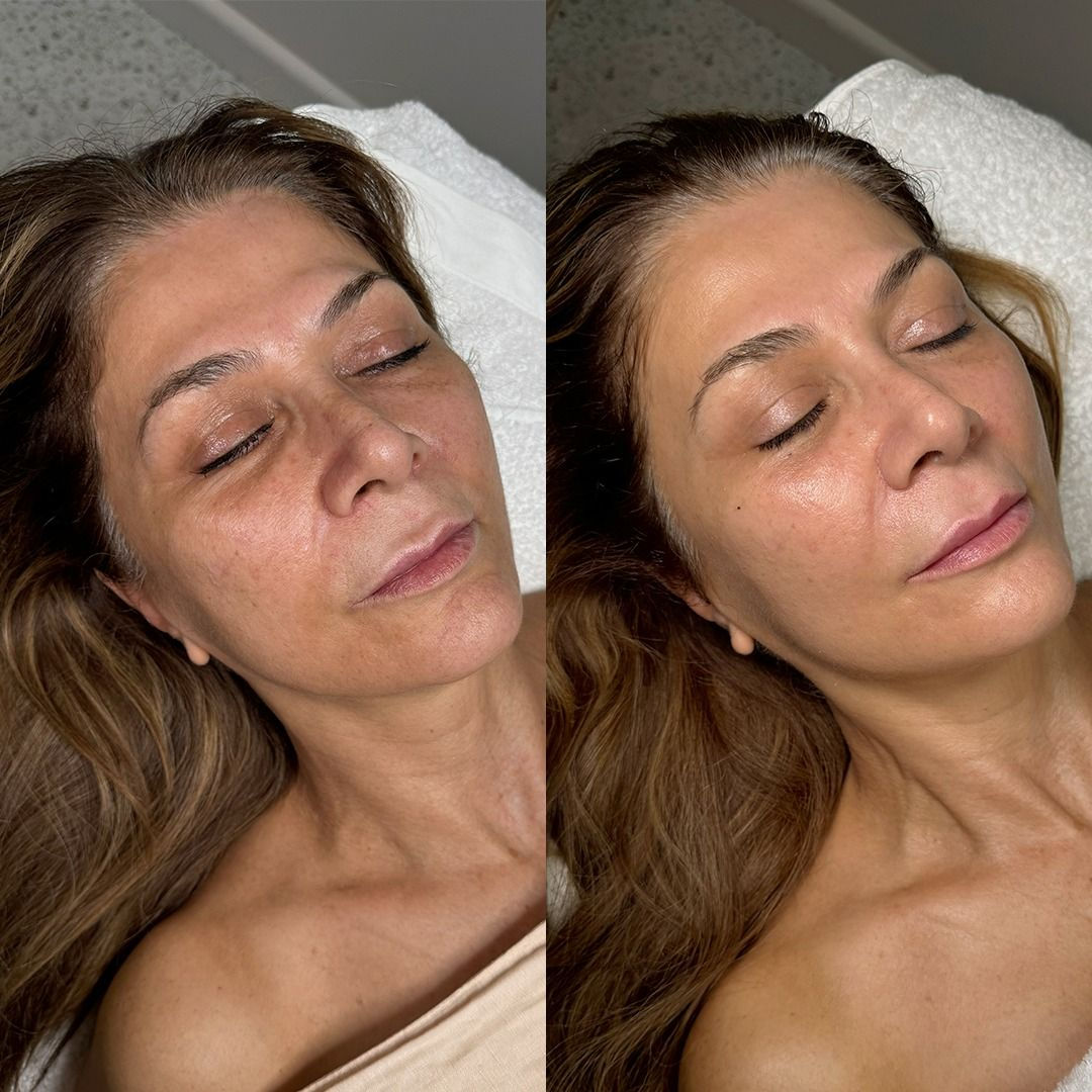 6 Month Skin Reset Plan by Dr Spiller personalised skin treatment