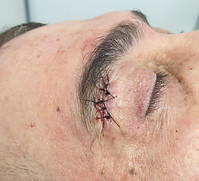 StitchedClosedEye_edited.jpg