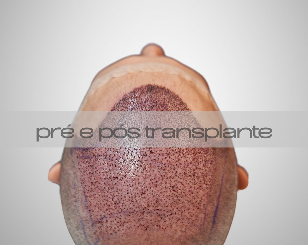 Tratamentos Capilares com tópicos e injetáveis com resultados comprovados.