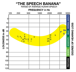 Speech_Banana_no_icons.png
