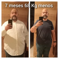 Cirugía bariátrica- casos reales
